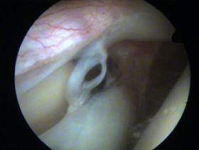 SLAP$20IV-250.jpg