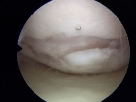 CM IV.JPG